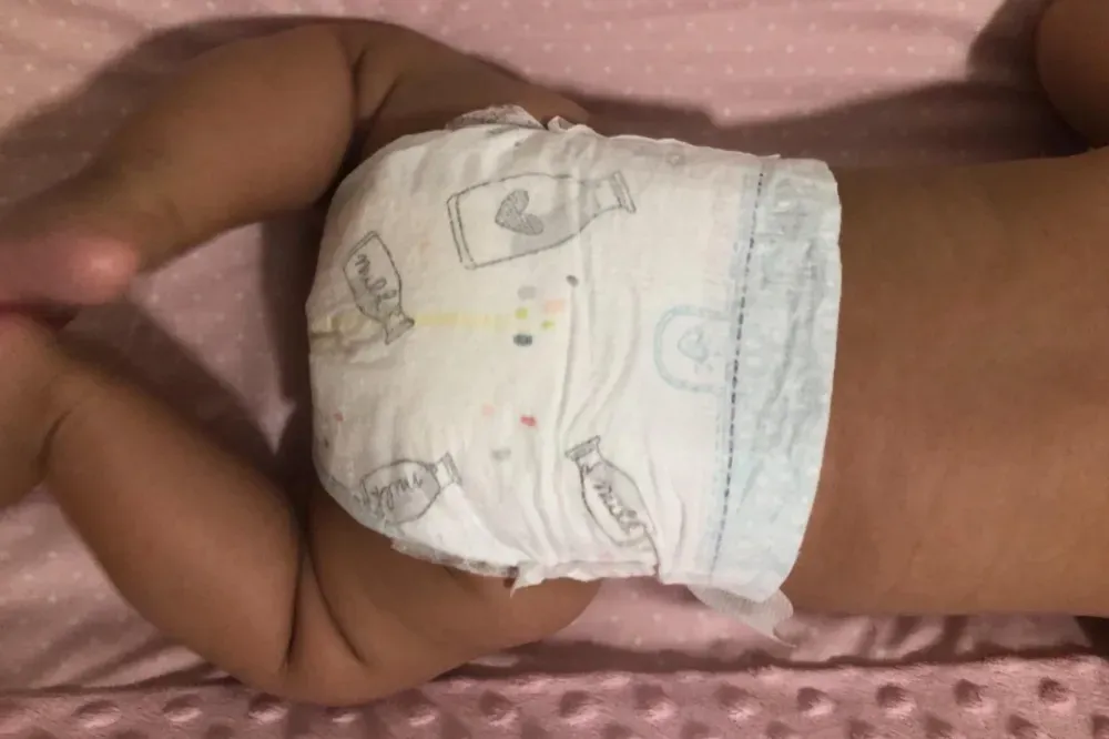 What are the best diapers for sensitive skin